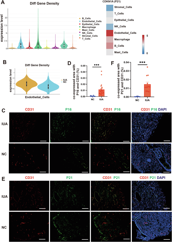 Fig. 1: Endometrial endothelial cells in IUA patients undergo senescence.
