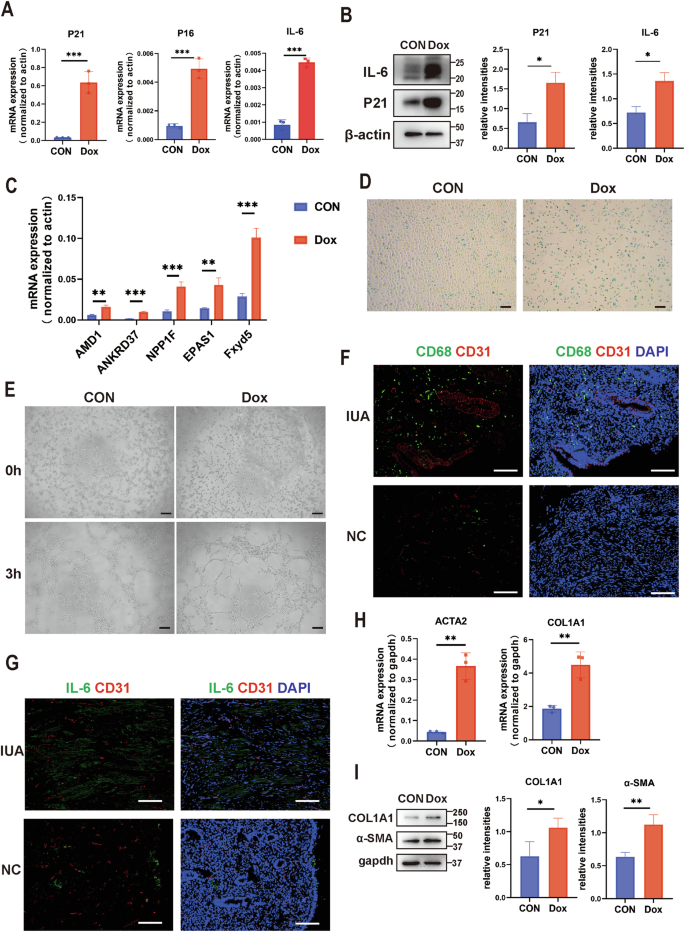 Fig. 2: Senescent endothelial cells impair angiogenesis and promote fibrosis of stromal cells.