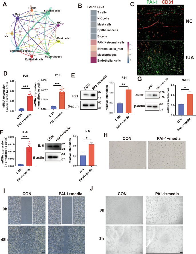 Fig. 3: PAI-1 derived from endometrial stromal cells promotes senescence of ECs.