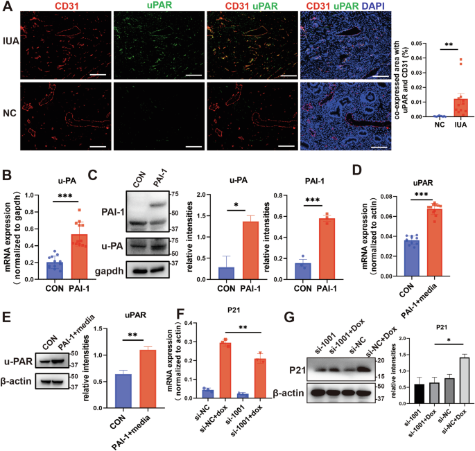 Fig. 4: PAI-1 promotes endothelial cell senescence through uPAR.