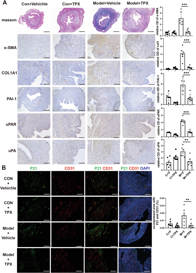 Fig. 6: PAI-1 inhibitors can inhibit endothelial senescence and endometrial fibrosis in mice.