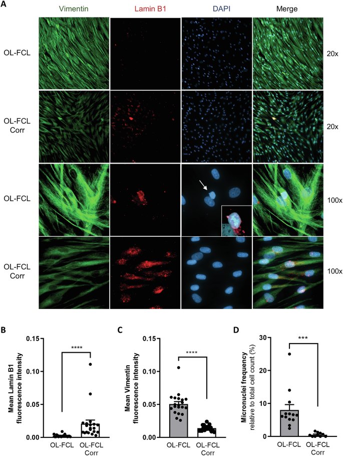 Fig. 6: FA-A fibroblasts are characterized by reduced lamin B1, increased vimentin and formation of numerous micronuclei.