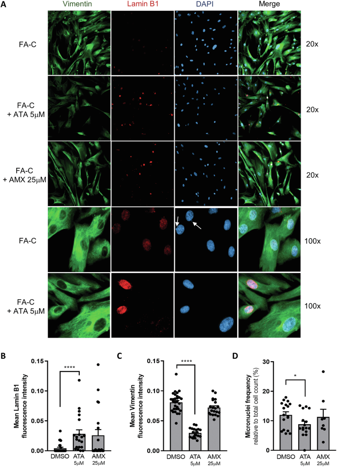 Fig. 7: Ataluren increased lamin B1 levels, while reducing vimentin and micronuclei frequency in primary FA-C fibroblasts.