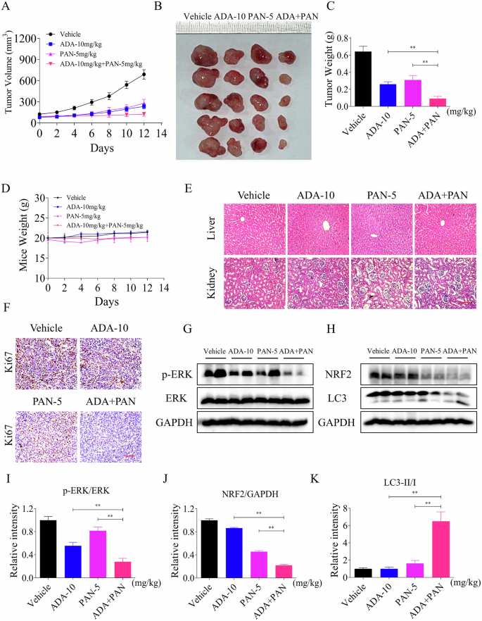 Fig. 10: ADA can cooperate with PAN to inhibit tumor growth in vivo.