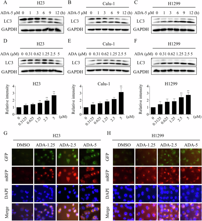 Fig. 6: ADA treatment activated autophagy in NSCLC cells.