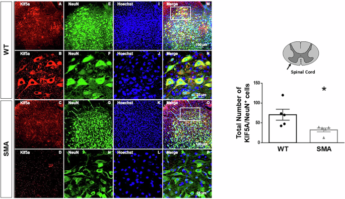 Fig. 3: KIF5A expression in the lumbar spinal cord of late symptomatic SMA mice.