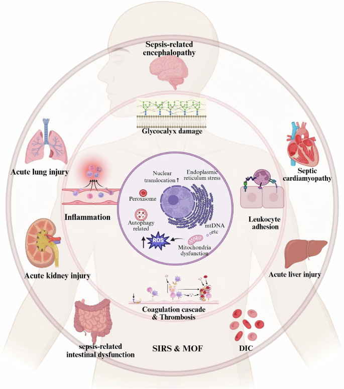 Fig. 4: The pathophysiologic process of ECs PCD in sepsis.