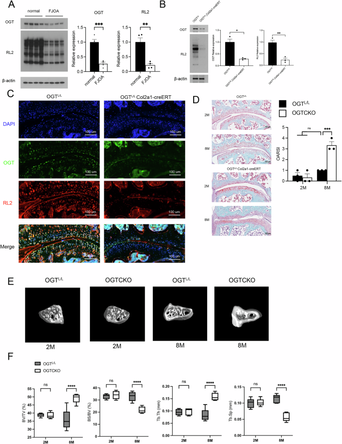 Fig. 1: OGT deletion results in spontaneous FJOA.