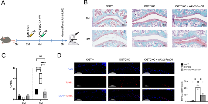 Fig. 5: AAV2-FoxO1 mitigates FJOA progression and chondrocyte apoptosis in OGT knockout mice.