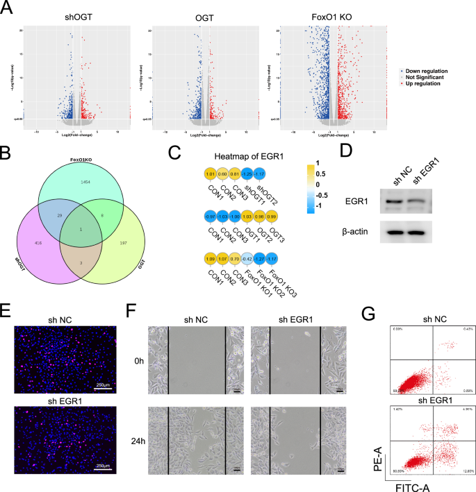 Fig. 7: Promotion of chondrocyte proliferation, migration, and inhibition of apoptosis by OGT/FoxO1 downstream target gene EGR1.