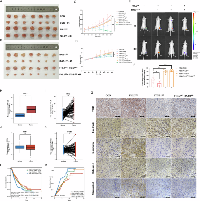 Fig. 7: Influence of FHL2 and ITGB1 on Tumor Growth, Radioresistance, and Prognostic Outcomes in NSCLC.
