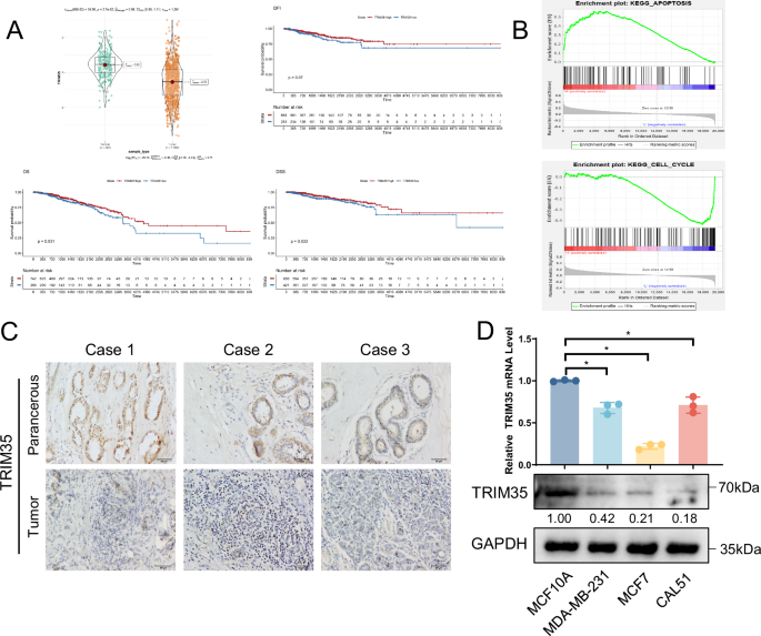 Fig. 1: TRIM35 is lowly expressed in breast cancer tissues and cells, and positively correlates with patient survival.