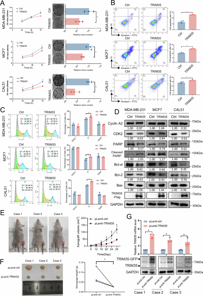 Fig. 2: TRIM35 overexpression suppresses breast cancer cell proliferation in vitro and in vivo.