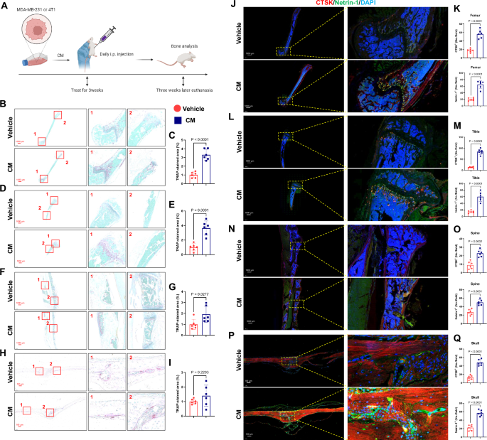 Fig. 1: Conditioned medium (CM) of cancer cells promoted osteoclastic pre-metastatic niche formation.
