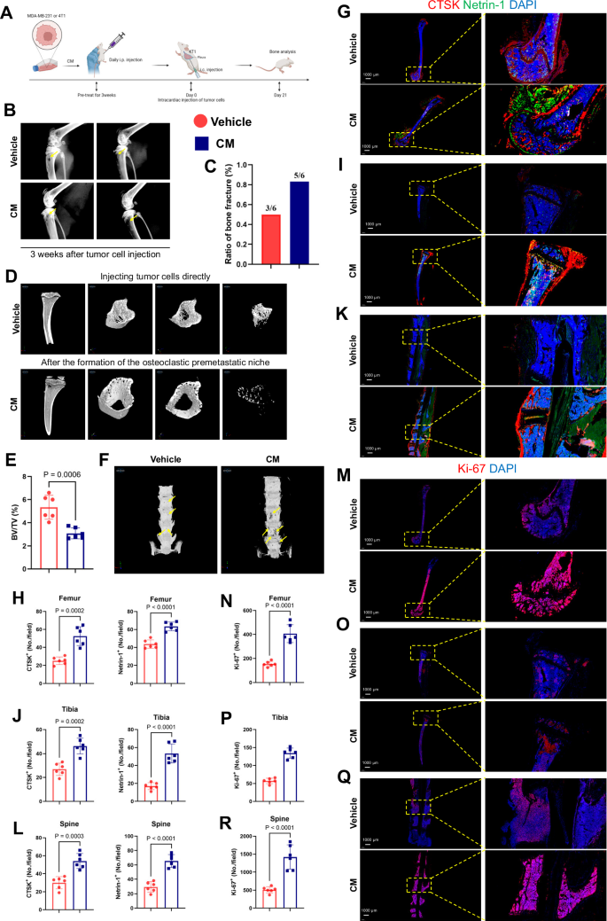 Fig. 2: Formation of osteoclastic pre-metastatic niche promotes bone metastasis.