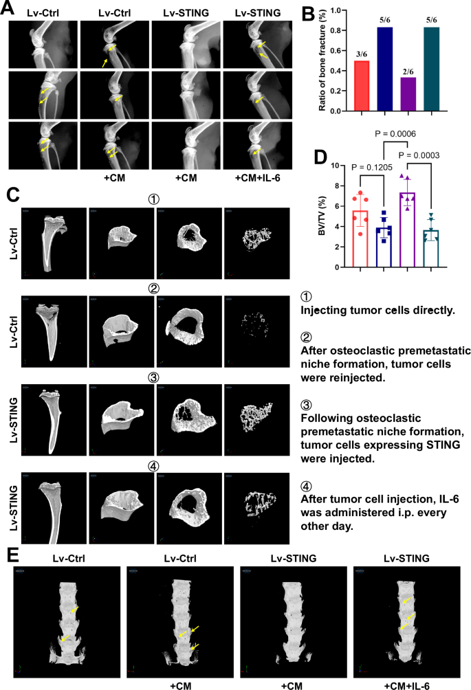 Fig. 6: The regulatory role of STING in tumor-induced bone destruction via OPN formation relies on the inhibition of IL-6.