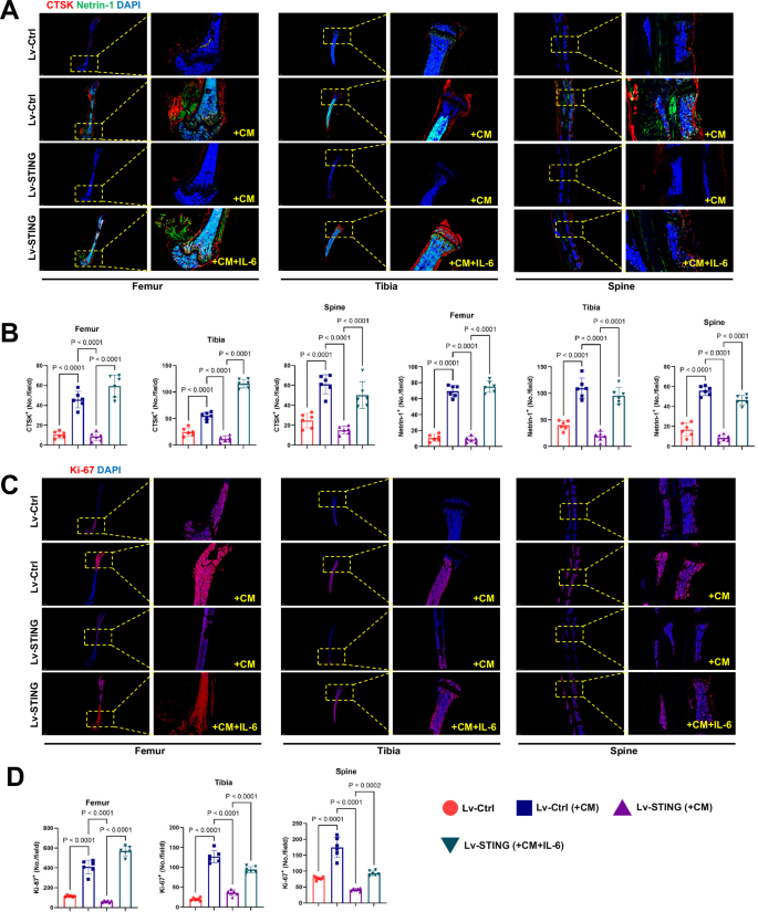 Fig. 7: Hijacking of STING expression in tumor cells by IL-6/STAT3 inhibits OPN formation and bone destruction.