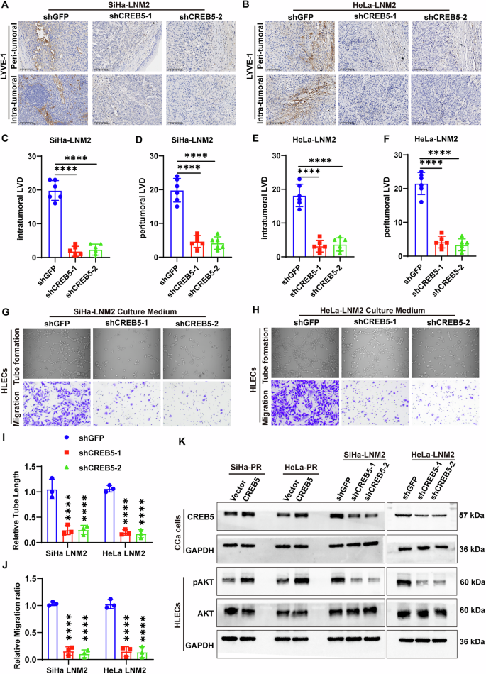 Fig. 3: CREB5 promotes lymphangiogenesis in CCa.