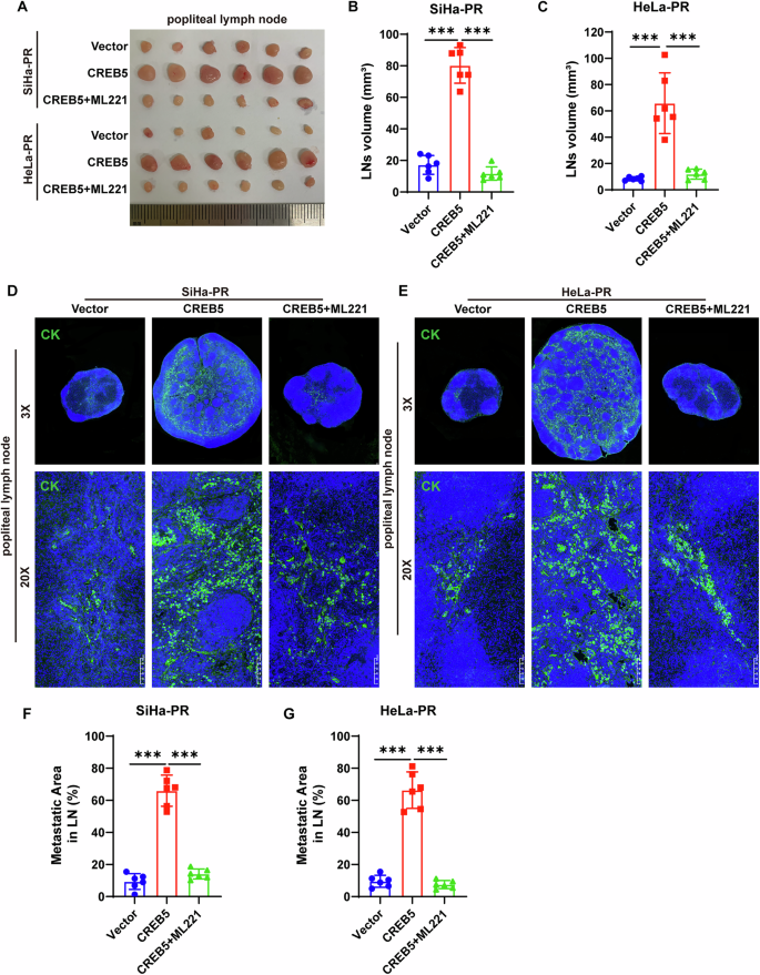 Fig. 5: CREB5 promotes cervical carcinoma nodal metastasis through an APLN-dependent mechanism.