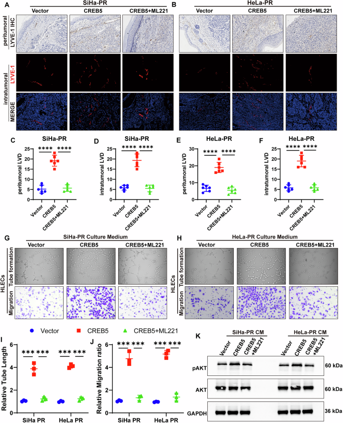 Fig. 6: CREB5 facilitates cervical carcinoma-associated lymphangiogenesis through APLN-dependent mechanisms.