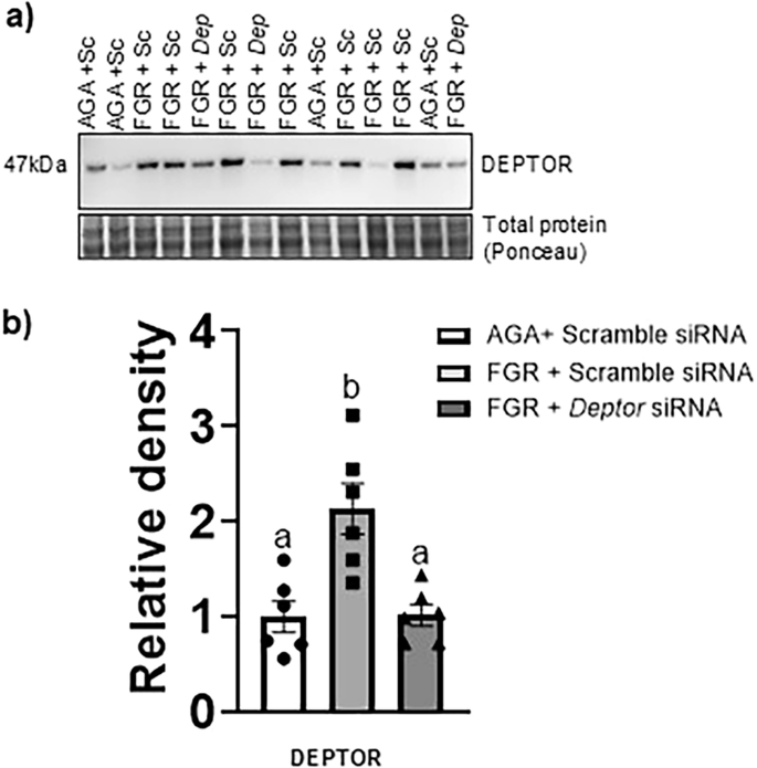 Fig. 2: Effect of DEPTOR siRNA silencing on DEPTOR protein expression in FGR PHT cells.