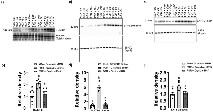 Fig. 6: Normalizing DEPTOR protein level in FGR PHT cells restores Nedd 4-2 expression and prevents Nedd4-2 mediated ubiquitination of the SNAT2 and LAT1.