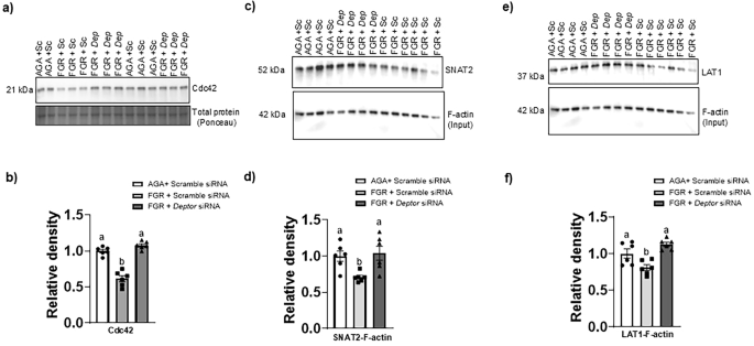 Fig. 7: Normalizing DEPTOR protein level in FGR PHT cells restores Cdc42 expression and restores the association of F-actin with SNAT2 and LAT1.