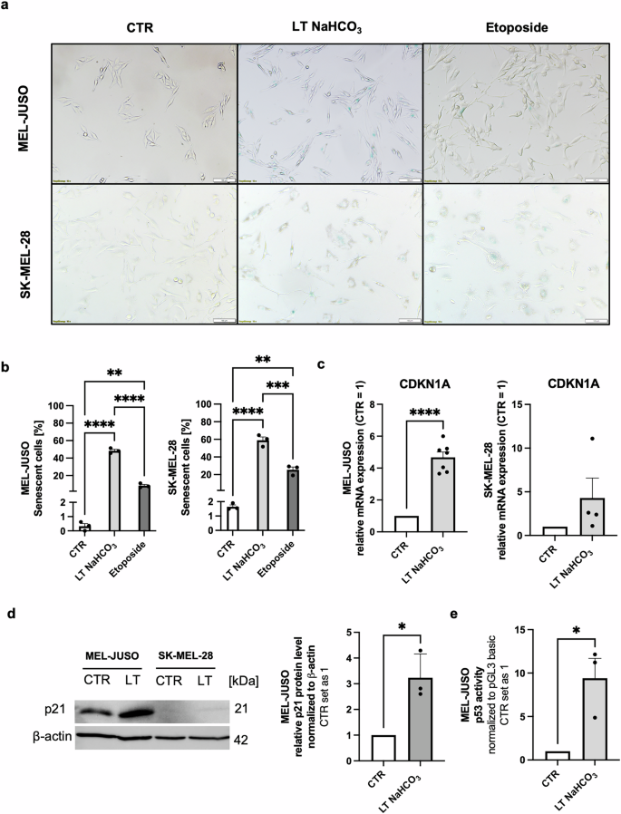 Fig. 1: Extracellular acidosis using NaHCO3 buffer induces a senescence-like phenotype in melanoma cells.