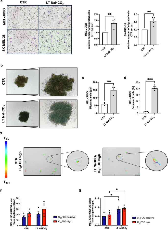 Fig. 5: Analysis of migratory phenotype after LT acidosis treatment of melanoma cells.