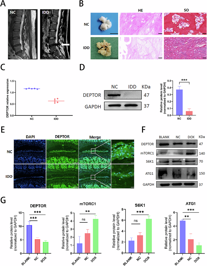 Fig. 1: Expression of DEPTOR in normal and degenerated human and rat intervertebral disks and expression of mTOR pathway–related proteins in senescent nucleus pulposus cells (NPCs).