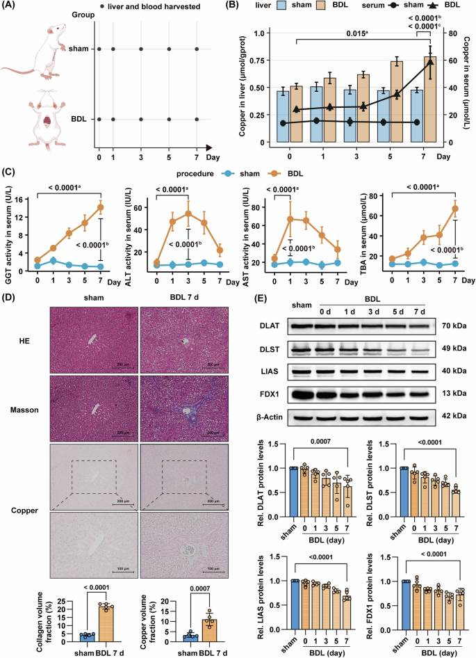Fig. 2: Obstructive cholestasis induces dysregulated copper homeostasis with concomitant liver injury and cuproptotic changes in rats.