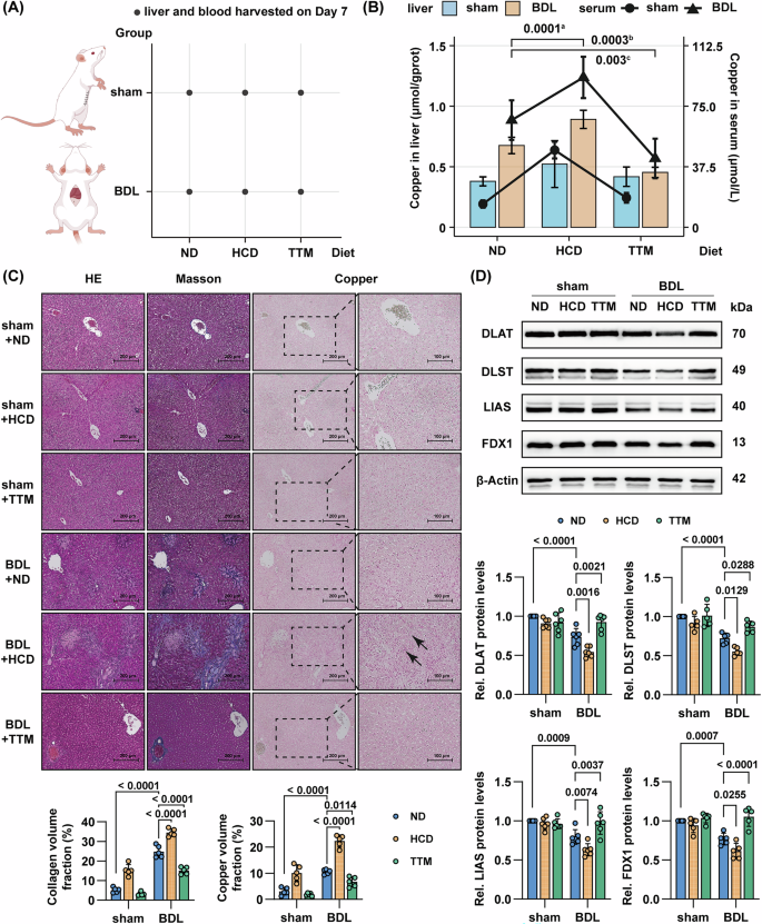 Fig. 3: High copper intake exacerbates BDL-induced liver injury and fibrogenesis, while TTM ameliorates hepatic pathology in rats.