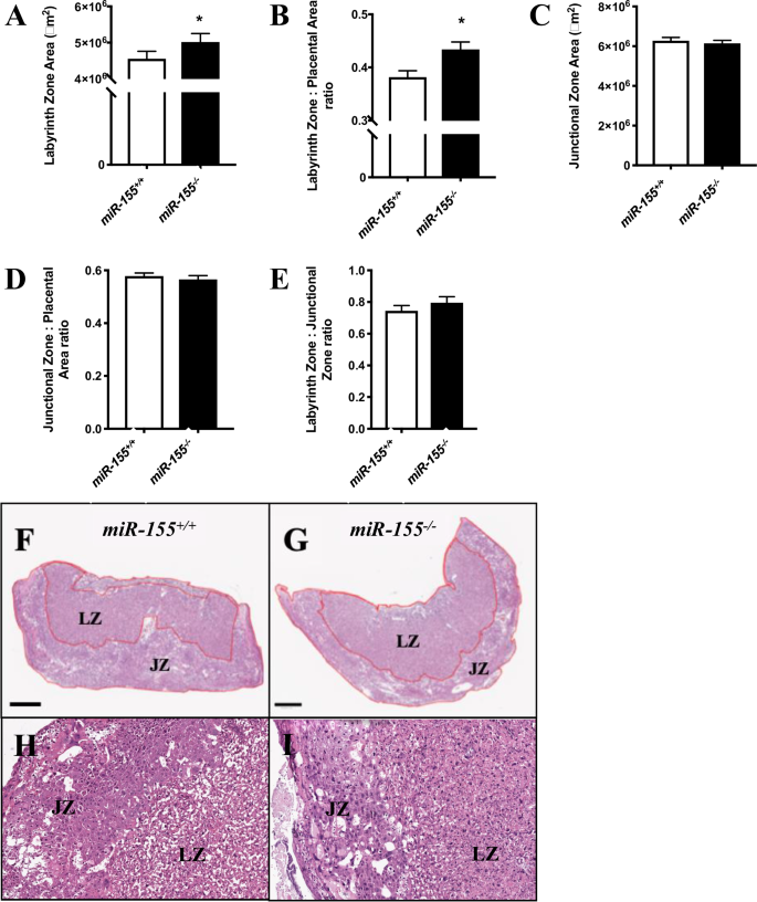 Fig. 2: Morphological analyses of placentae from miR-155-/- and miR-155+/+ mice at pc day 18.5.