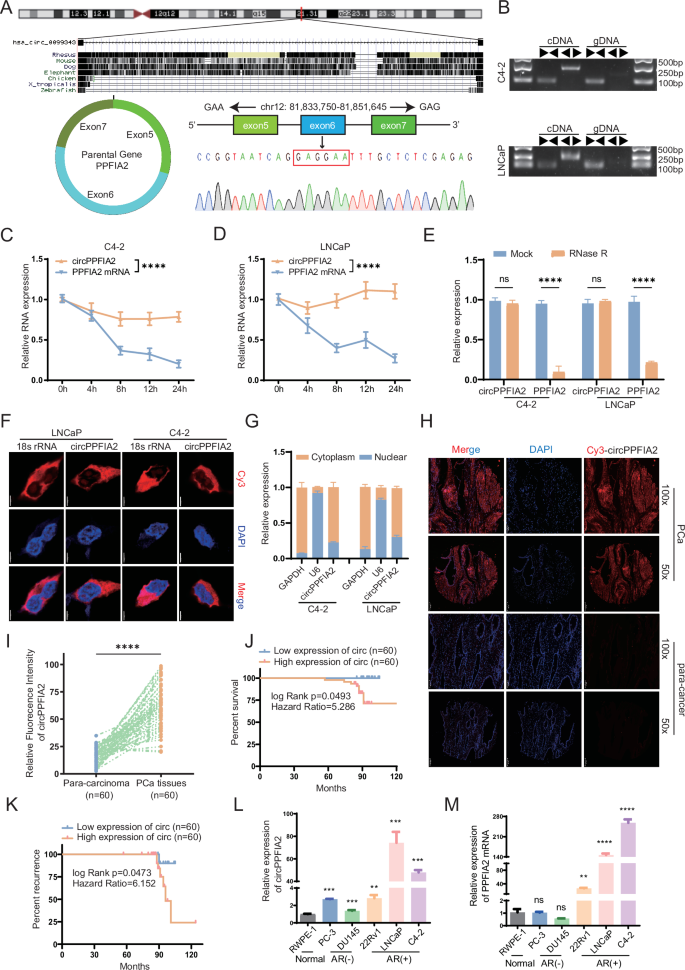 Fig. 1: CircPPFIA2 is upregulated and predicts adverse clinical Outcomes of PCa.