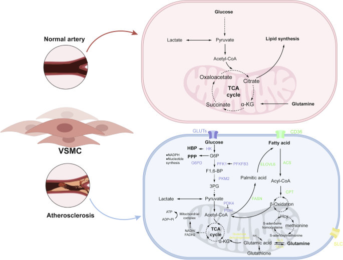 Vascular smooth muscle cell metabolic reprogramming and phenotypic remodeling in atherosclerosis