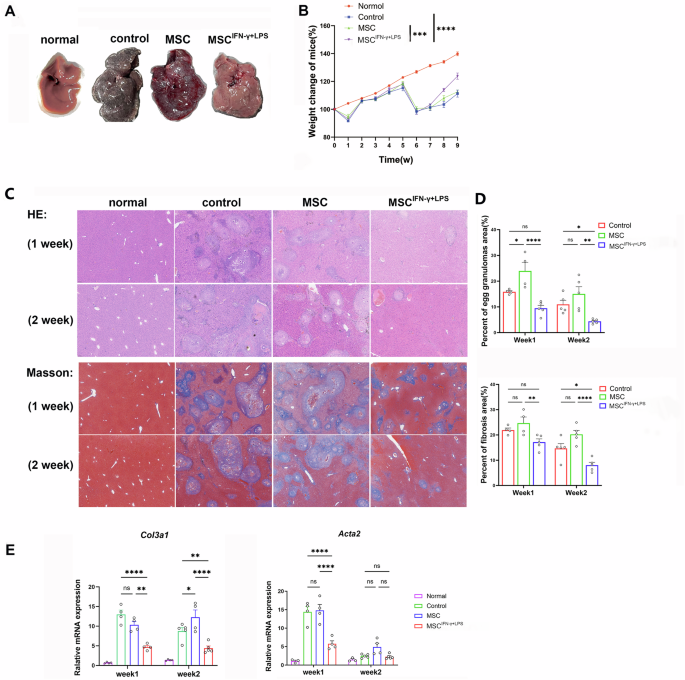 Fig. 1: IFN-γ + LPS-primed MSCs alleviated liver pathology in mice infected with Schistosoma japonicum.