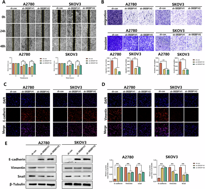 Fig. 3: SREBP1 knockdown inhibits migration and invasion via EMT suppression.