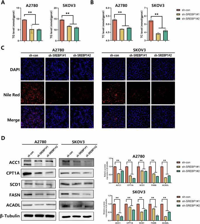 Fig. 4: Silencing SREBP1 suppresses lipid metabolism in OV cells.