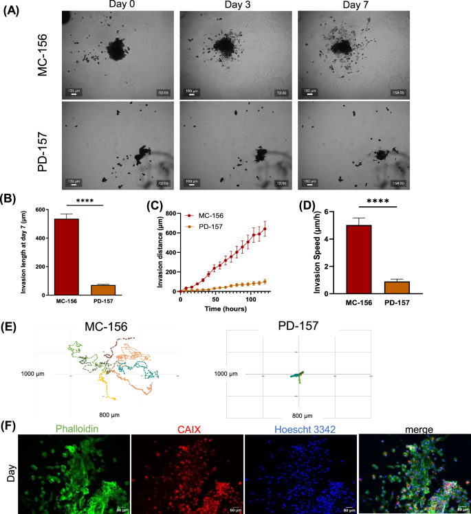 Fig. 5: 3D human renal tumoroid invasion assay.