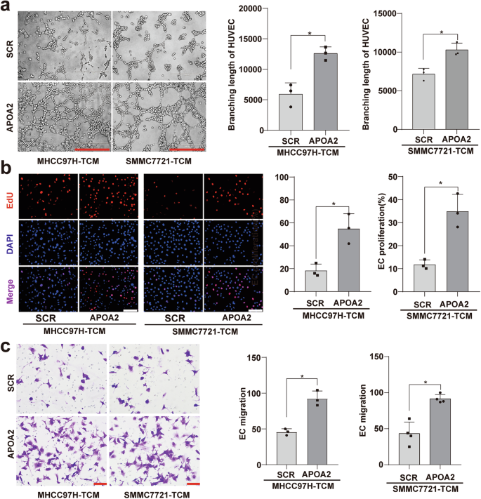 Fig. 5: The conditional medium from HCC cells overexpressing APOA2 on HUVEC proliferation, migration, and tubular formation.