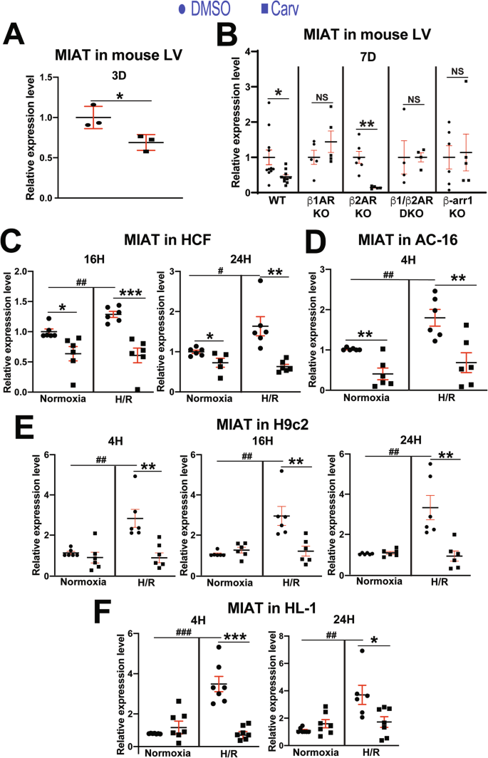 Fig. 1: MIAT is downregulated in mouse left ventricles, human cardiac fibroblasts, and human and rodent cardiomyocytes by carvedilol.
