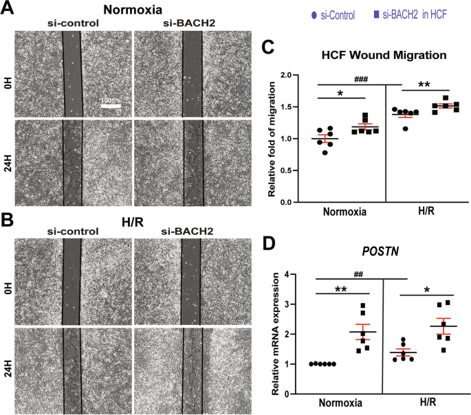 Fig. 6: BACH2 suppresses migration of primary adult human cardiac fibroblasts and inhibits the expression of profibrotic POSTN.