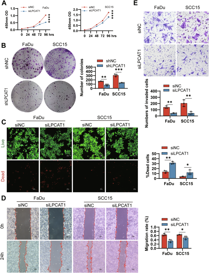 Fig. 3: LPCAT1 knockdown suppresses HNSCC cell proliferation, migration, and invasion in vitro.