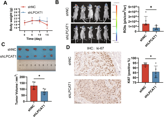 Fig. 4: LPCAT1 knockdown suppresses tumor growth in vivo.