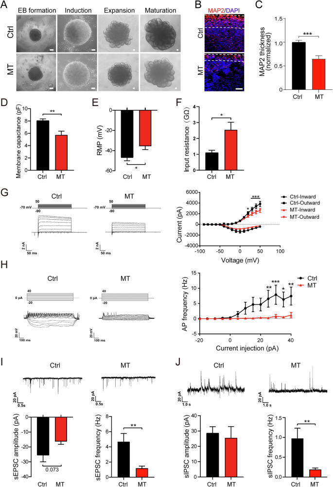 Fig. 5: CSF1R-MT delays neurodevelopment and impairs synaptic function in COs.