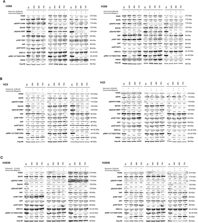 Fig. 2: Western blot analysis of sotorasib, fulzerasib, cetuximab and sotorasib/fulzerasib combined with cetuximab.