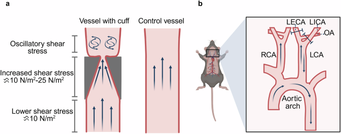 Fig. 2: Schematic diagram of disturbed blood flow inducing EndMT and atherosclerosis in animal models.