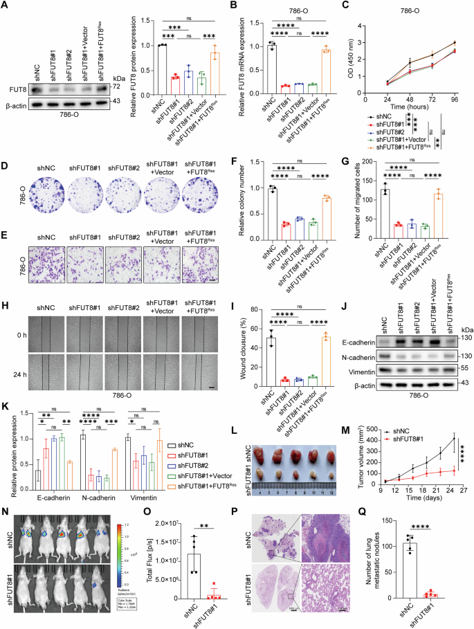 Fig. 2: Knockdown of FUT8 suppresses ccRCC proliferation and migration in vitro and in vivo.