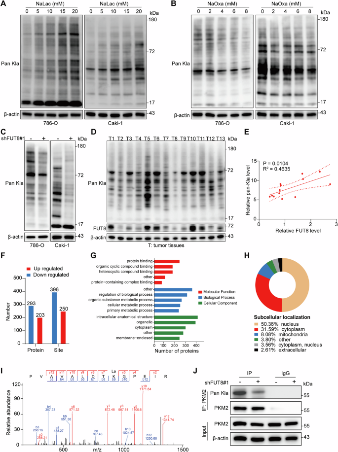 Fig. 5: FUT8 regulates pan-lysine lactylation and promotes PKM2 lactylation in ccRCC.