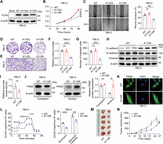 Fig. 6: PKM2 K115 lactylation promotes glycolysis and malignant phenotypes in ccRCC.